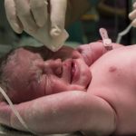 6 Jenis Cedera Lahir yang Bisa Dialami Bayi saat Proses Persalinan