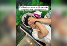 Willie Salim Sunat di Usia 24 Tahun, Sebut Deg-degan hingga “OTW Ganti Skin”